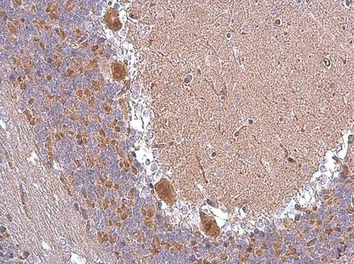 ABAT Antibody in Immunohistochemistry (Paraffin) (IHC (P))