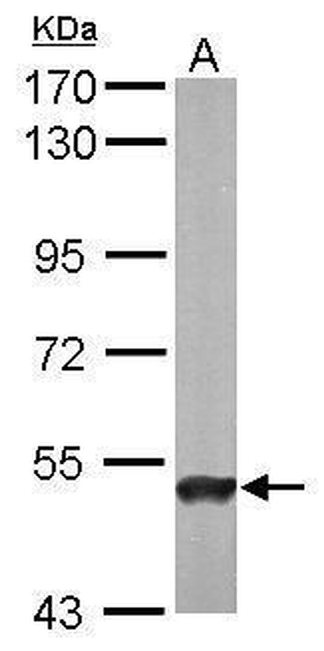 ABAT Antibody in Western Blot (WB)