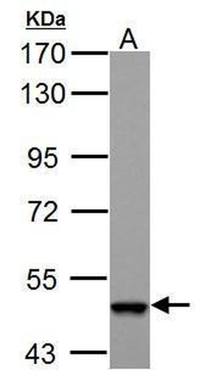 ABAT Antibody in Western Blot (WB)