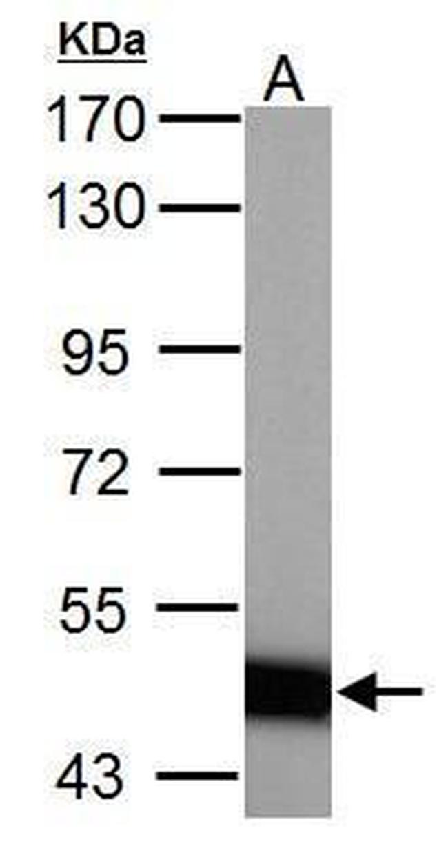 ABAT Antibody in Western Blot (WB)