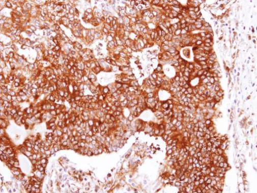 HSP90 beta Antibody in Immunohistochemistry (Paraffin) (IHC (P))