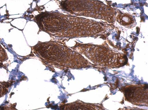 eIF3d Antibody in Immunohistochemistry (Paraffin) (IHC (P))