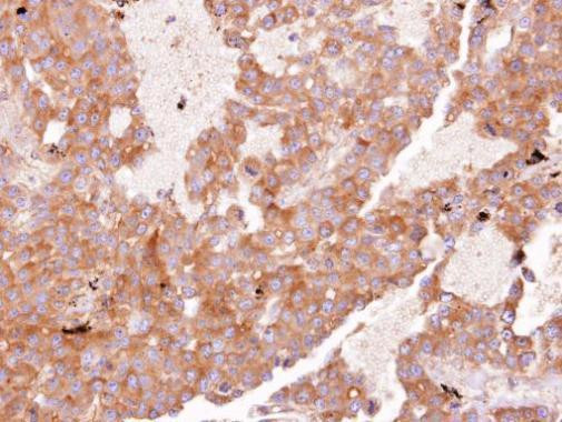 eIF3d Antibody in Immunohistochemistry (Paraffin) (IHC (P))