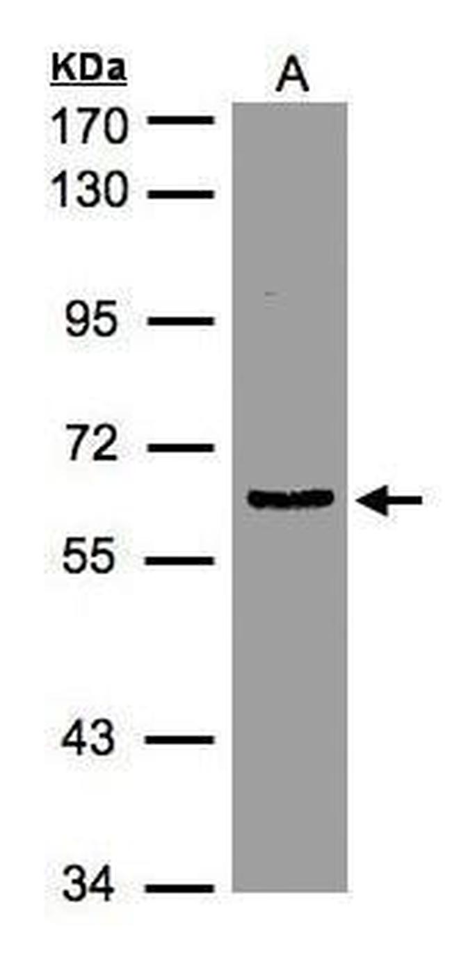 eIF3d Antibody in Western Blot (WB)