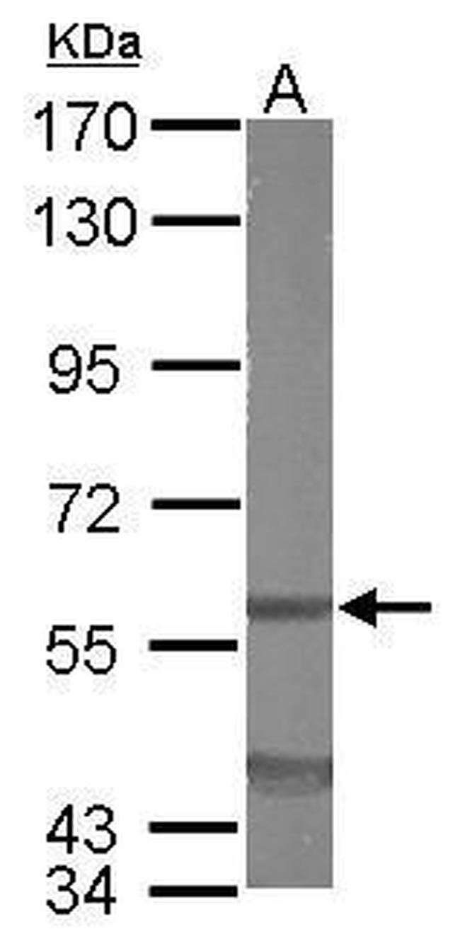 eIF3d Antibody in Western Blot (WB)