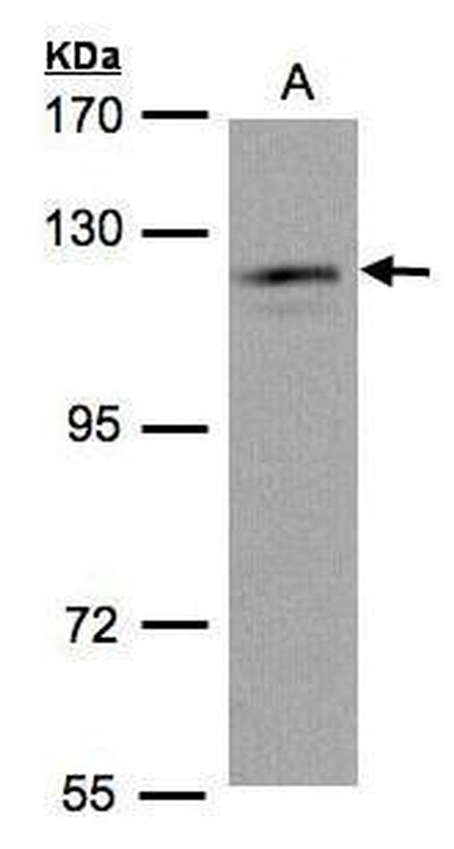 USP11 Antibody in Western Blot (WB)