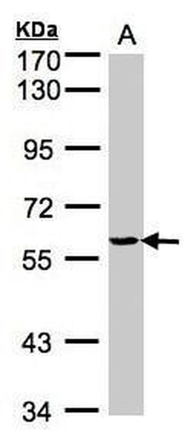 YARS Antibody in Western Blot (WB)