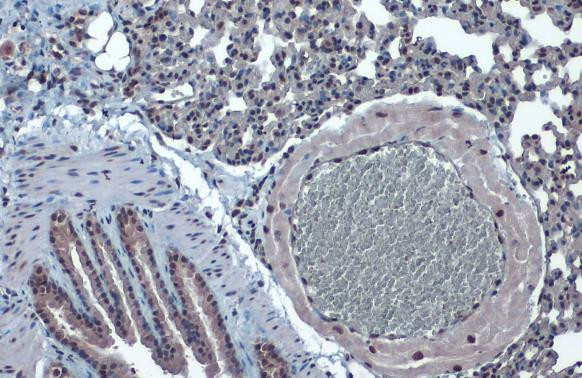 KLF4 Antibody in Immunohistochemistry (Paraffin) (IHC (P))