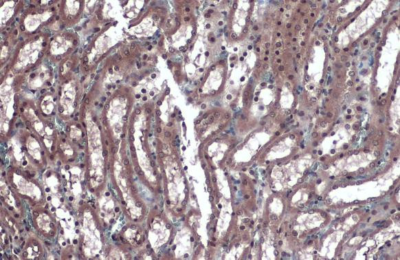 KLF4 Antibody in Immunohistochemistry (Paraffin) (IHC (P))