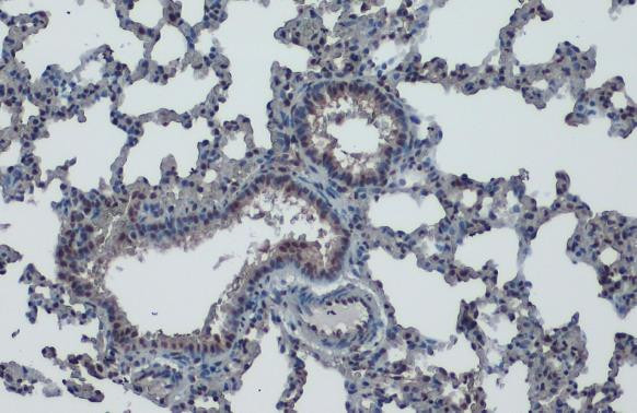 KLF4 Antibody in Immunohistochemistry (Paraffin) (IHC (P))