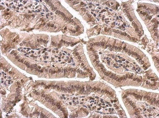 PABP Antibody in Immunohistochemistry (Paraffin) (IHC (P))