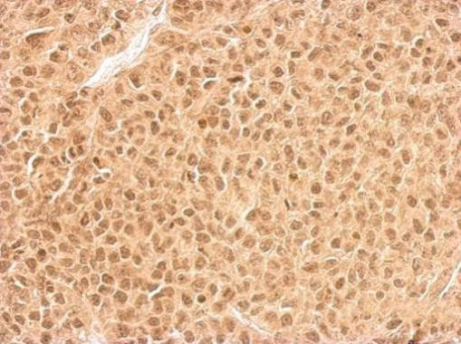 RPL11 Antibody in Immunohistochemistry (Paraffin) (IHC (P))