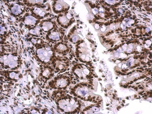 SNRPA Antibody in Immunohistochemistry (Paraffin) (IHC (P))