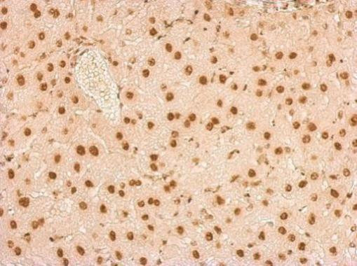 SNRPA Antibody in Immunohistochemistry (Paraffin) (IHC (P))