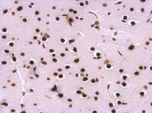 SNRPA Antibody in Immunohistochemistry (Paraffin) (IHC (P))