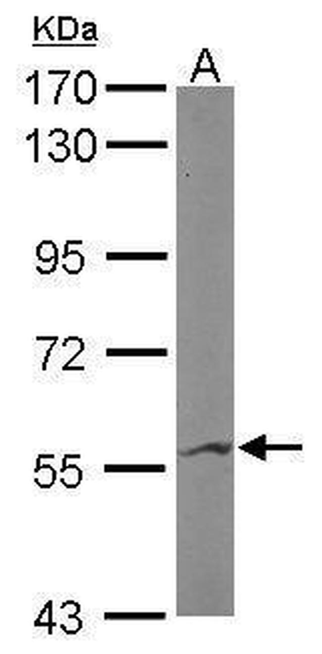 IMPDH2 Antibody in Western Blot (WB)