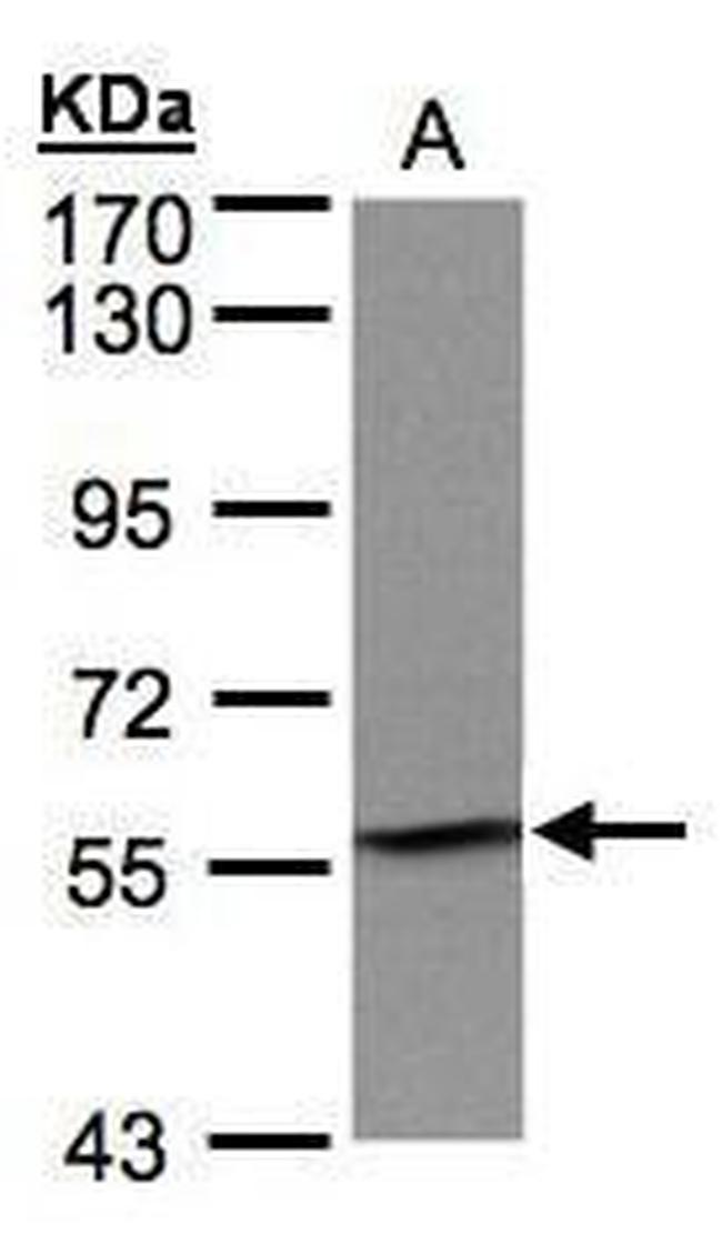 IMPDH2 Antibody in Western Blot (WB)