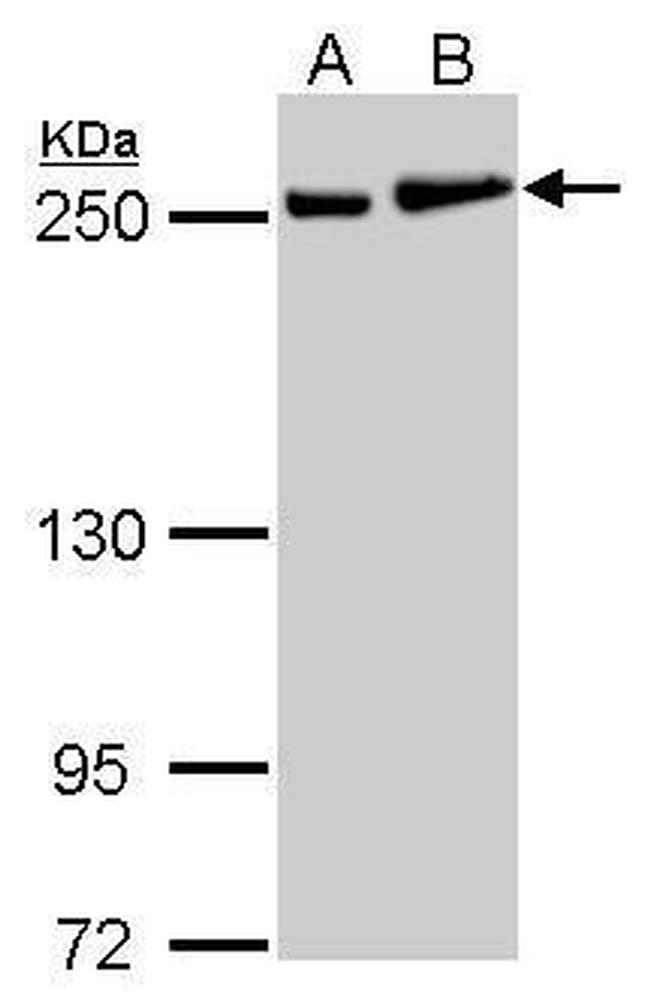 MYH9 Antibody in Western Blot (WB)