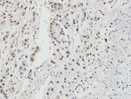 RPA2 Antibody in Immunohistochemistry (Paraffin) (IHC (P))