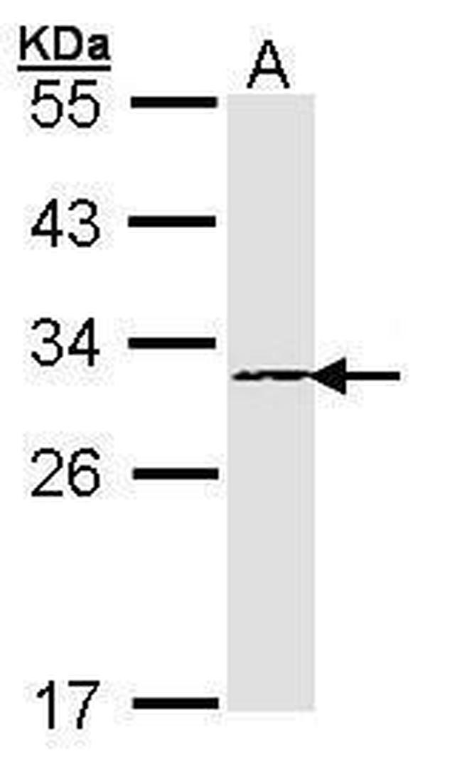 PSMB4 Antibody in Western Blot (WB)