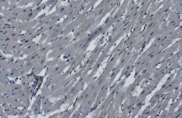 hnRNP K Antibody in Immunohistochemistry (Paraffin) (IHC (P))