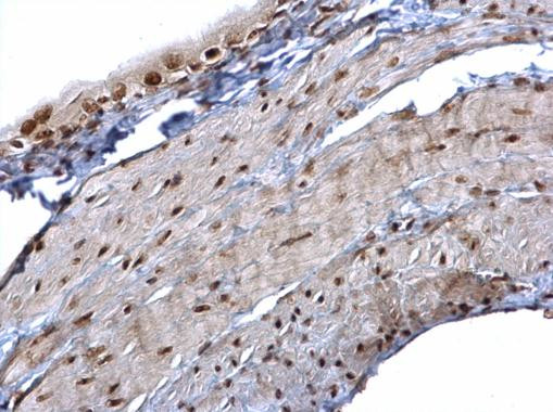 hnRNP K Antibody in Immunohistochemistry (Paraffin) (IHC (P))