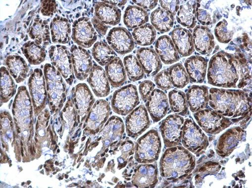 hnRNP K Antibody in Immunohistochemistry (Paraffin) (IHC (P))