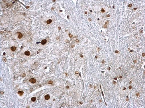 hnRNP K Antibody in Immunohistochemistry (Paraffin) (IHC (P))