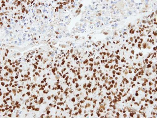 hnRNP K Antibody in Immunohistochemistry (Paraffin) (IHC (P))