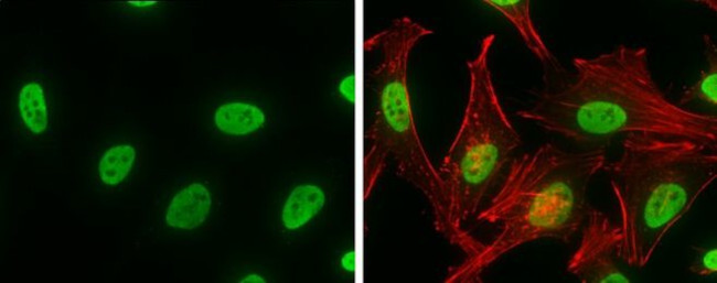 hnRNP K Antibody in Immunocytochemistry (ICC/IF)