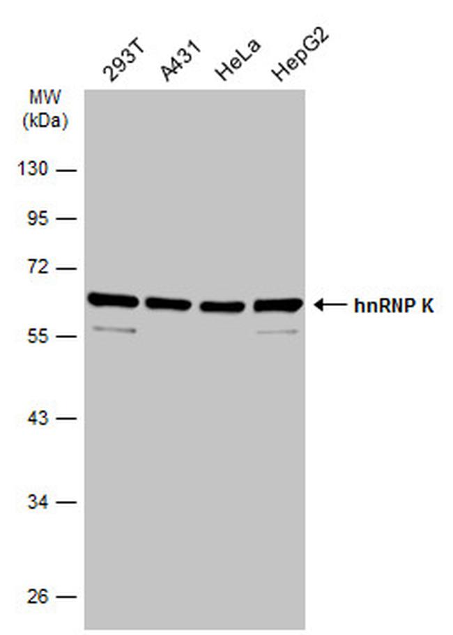 hnRNP K Antibody in Western Blot (WB)