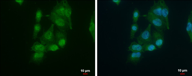 hnRNP D Antibody in Immunocytochemistry (ICC/IF)