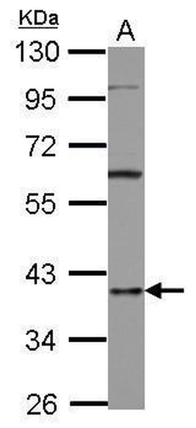 hnRNP D Antibody in Western Blot (WB)