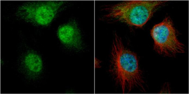 hnRNP D Antibody in Immunocytochemistry (ICC/IF)