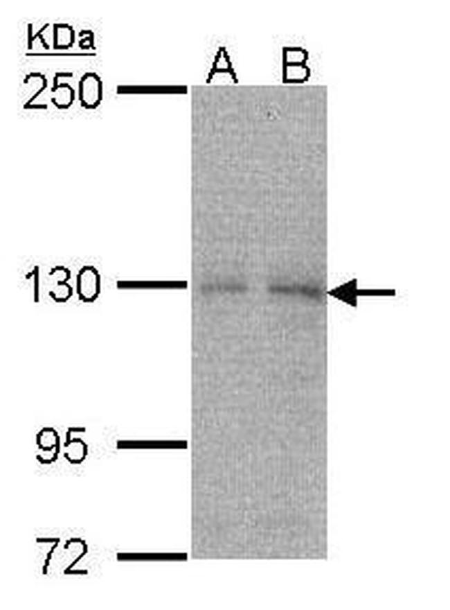 NYREN18 Antibody in Western Blot (WB)