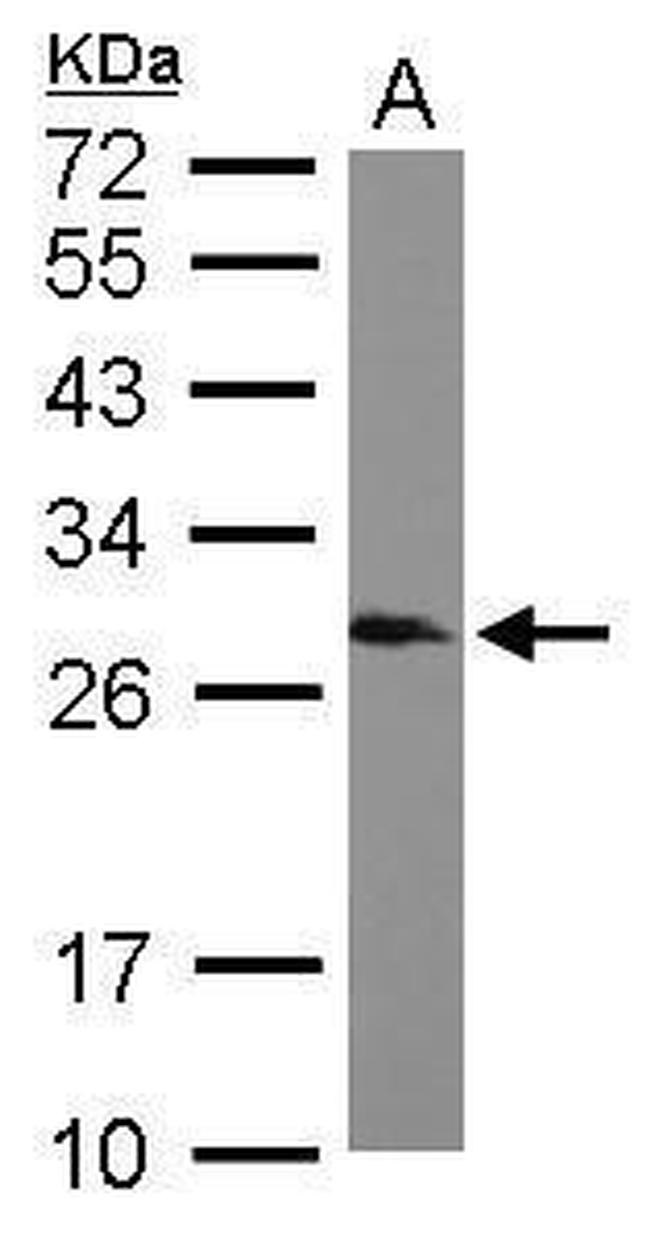 SNRPB Antibody in Western Blot (WB)