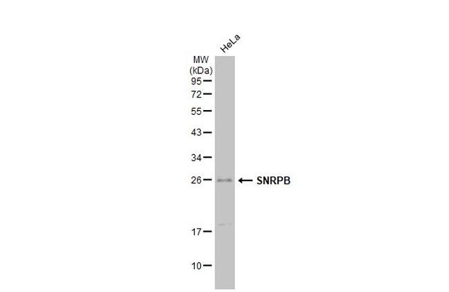 SNRPB Antibody in Western Blot (WB)