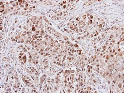 RPS6KB2 Antibody in Immunohistochemistry (Paraffin) (IHC (P))