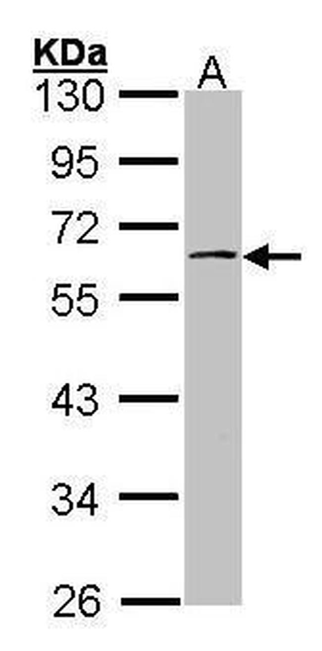 RPS6KB2 Antibody in Western Blot (WB)