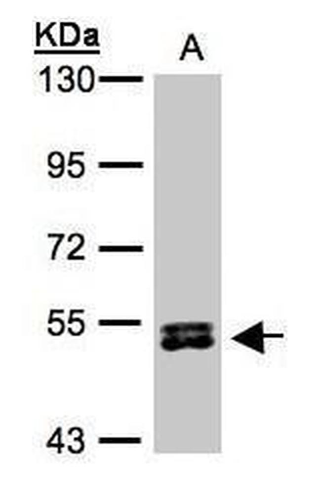 RPS6KB2 Antibody in Western Blot (WB)