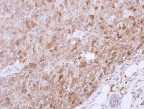 VGAT Antibody in Immunohistochemistry (Paraffin) (IHC (P))