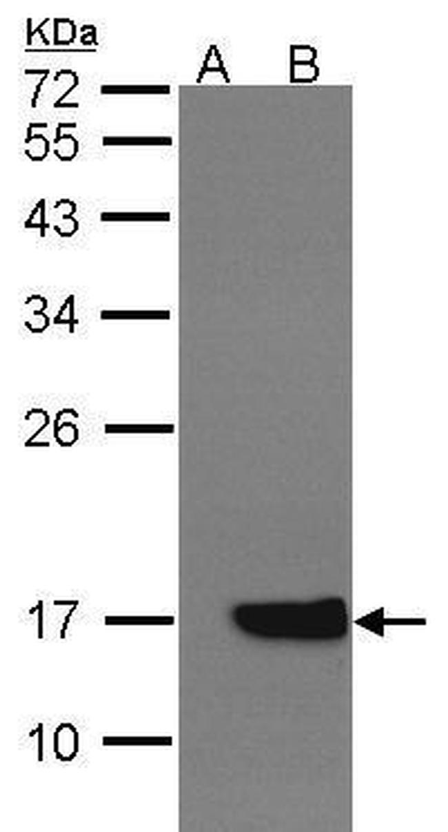 Cytochrome B5 Antibody in Western Blot (WB)