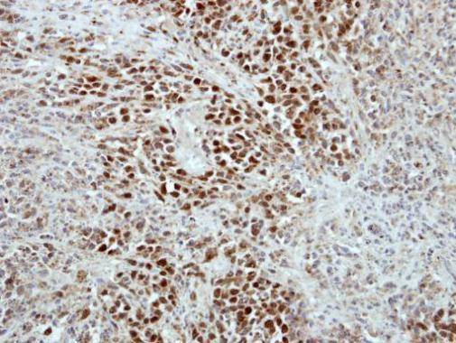 RAP1 Antibody in Immunohistochemistry (Paraffin) (IHC (P))