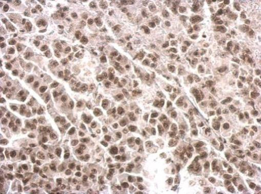 COBRA1 Antibody in Immunohistochemistry (Paraffin) (IHC (P))