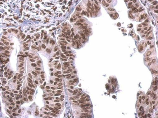 COBRA1 Antibody in Immunohistochemistry (Paraffin) (IHC (P))