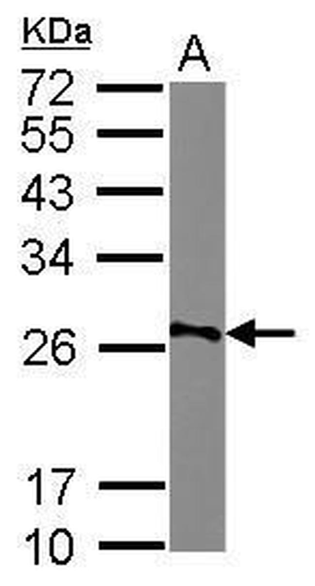 AGPAT1 Antibody in Western Blot (WB)