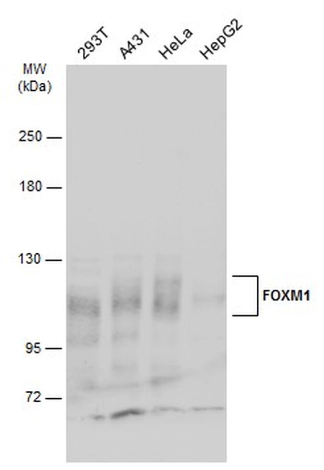 FOXM1 Antibody in Western Blot (WB)