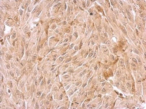 WDR1 Antibody in Immunohistochemistry (Paraffin) (IHC (P))