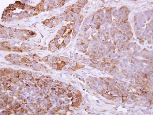 Talin 1 Antibody in Immunohistochemistry (Paraffin) (IHC (P))