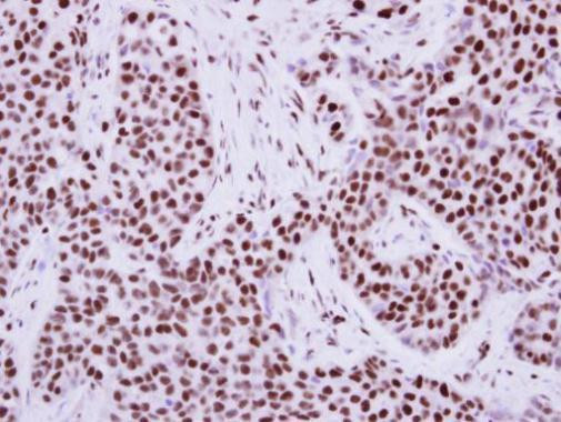 TRIM28 Antibody in Immunohistochemistry (Paraffin) (IHC (P))